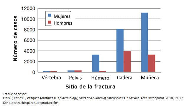 Grafico comparativo de areas de fracturas