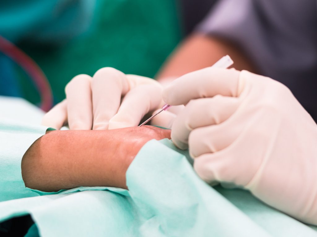 Terapia de mano después de una cirugía